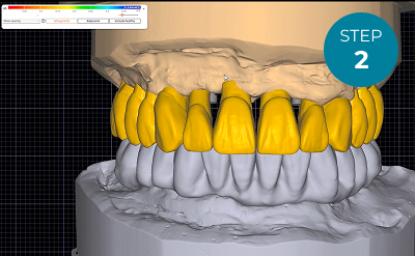 Step2_Design_and_Validate_the_Final_Tooth