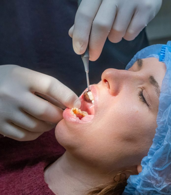 Dental,Implant,Preparation,With,Surgical,Instruments,Used,To,Work,On